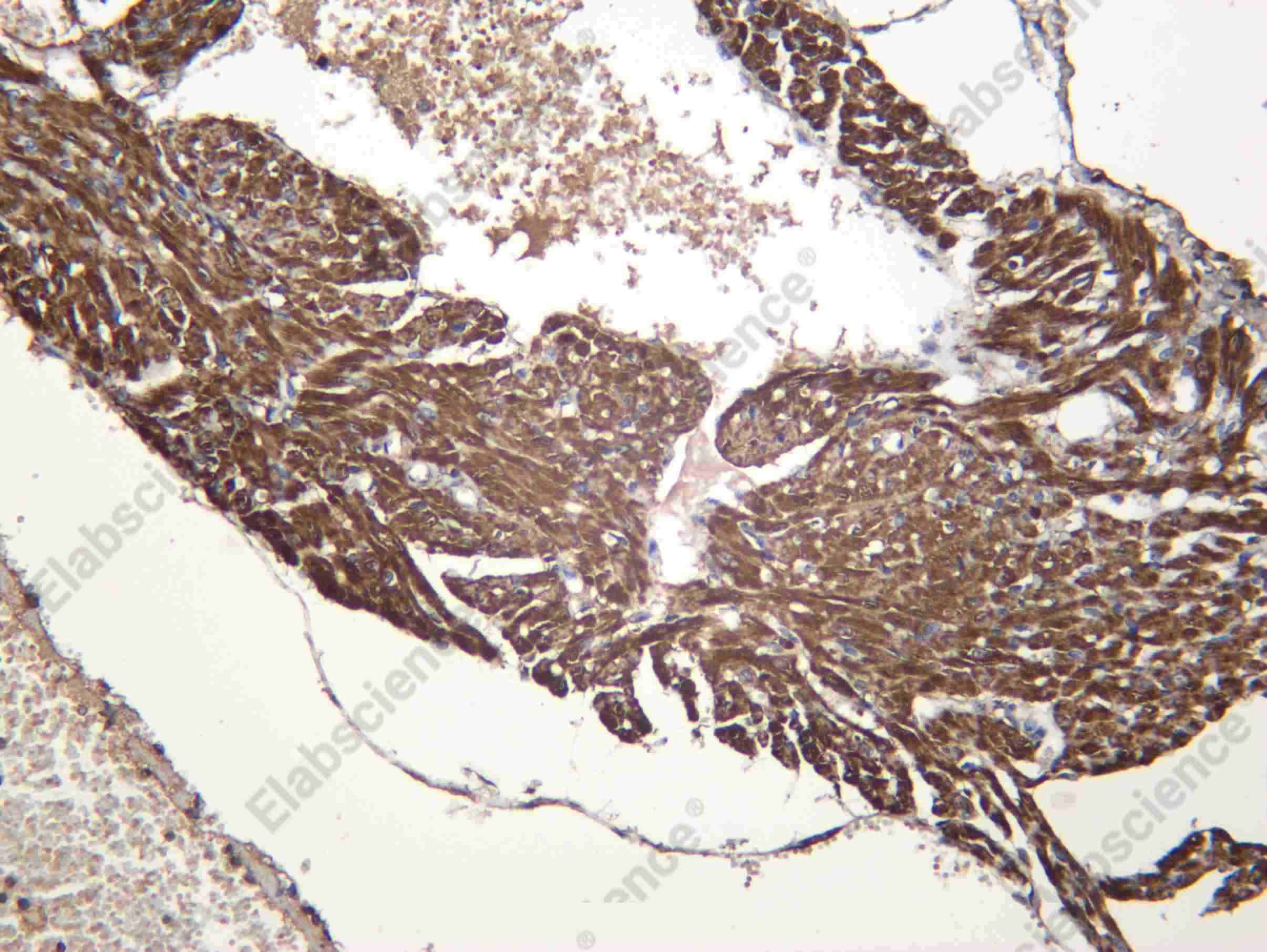 Recombinant AATC Monoclonal Antibody - 3