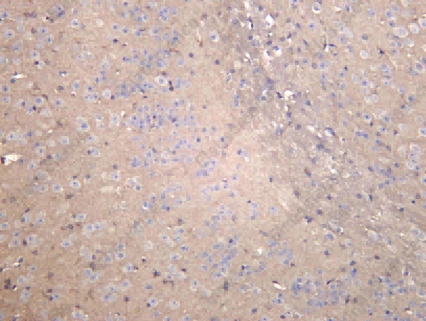 Recombinant SFRP3 Monoclonal Antibody - 1