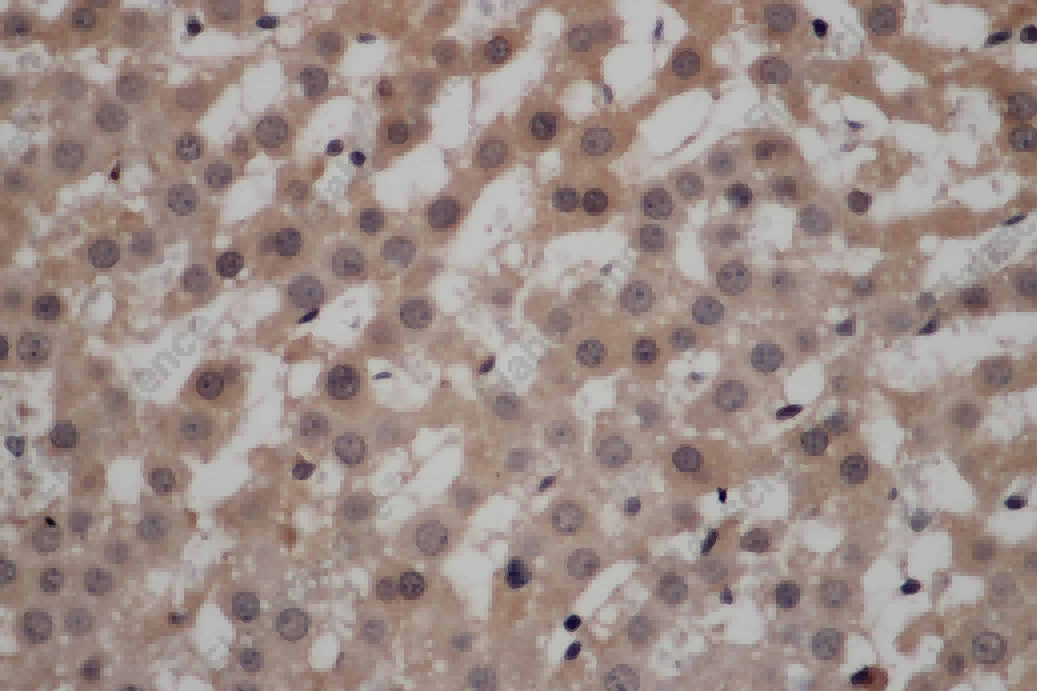 CALCRL Polyclonal Antibody - 2