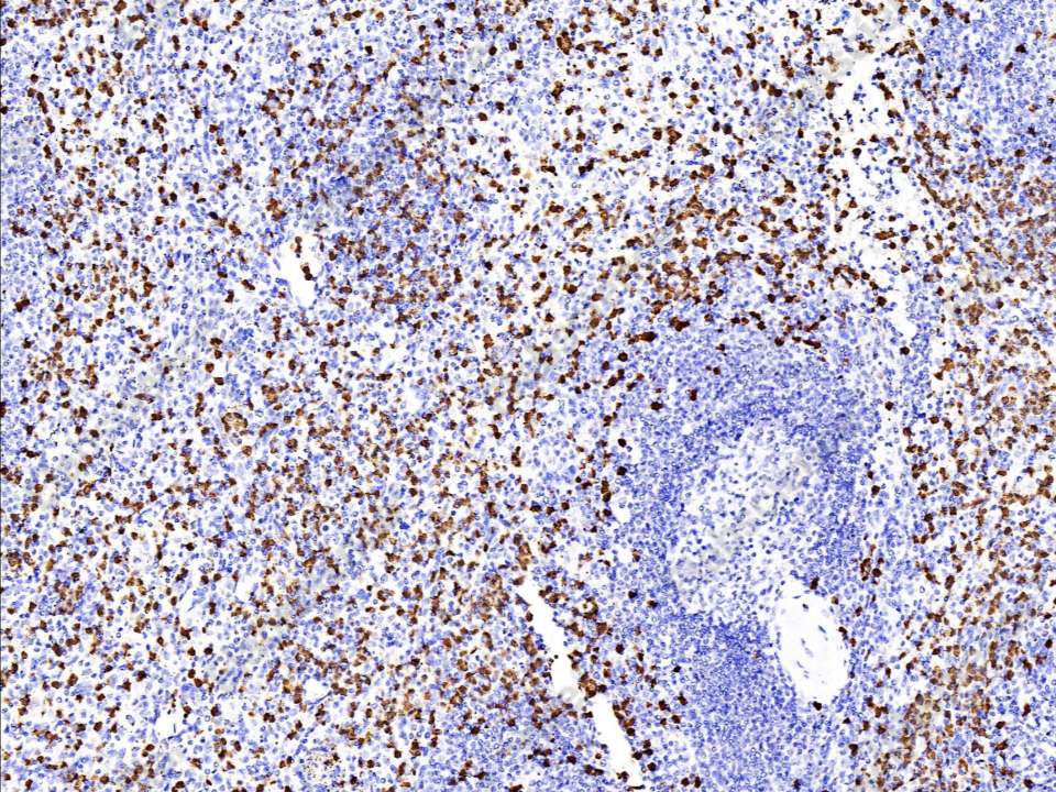 Recombinant S100A9 Monoclonal Antibody - 1