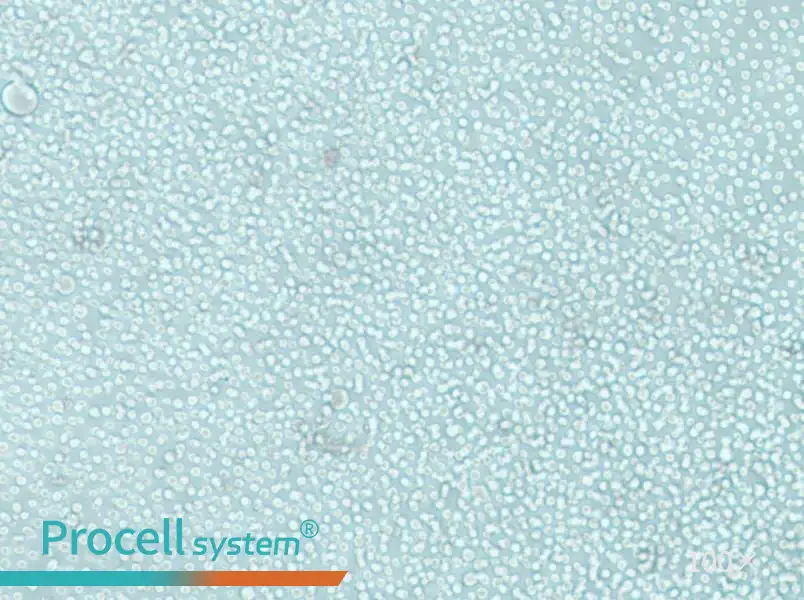 LAMA-84 Cell Complete MediumLAMA-84 Cell Complete Medium - 3