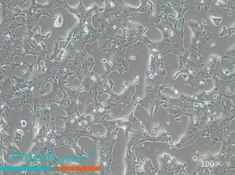 UPCI-SCC-090 Cell Complete MediumUPCI-SCC-090 Cell Complete Medium - 2