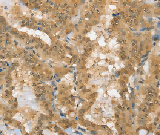 PSMC1 Polyclonal Antibody - 2
