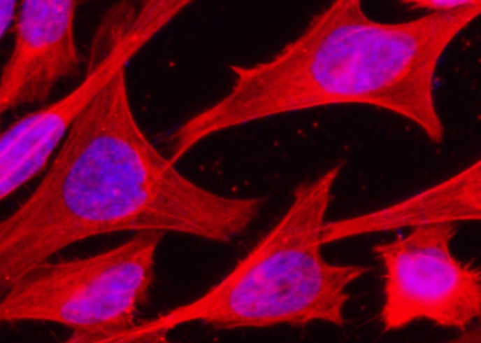 Recombinant HSP70/HSPA1A Monoclonal Antibody-searchlist-1