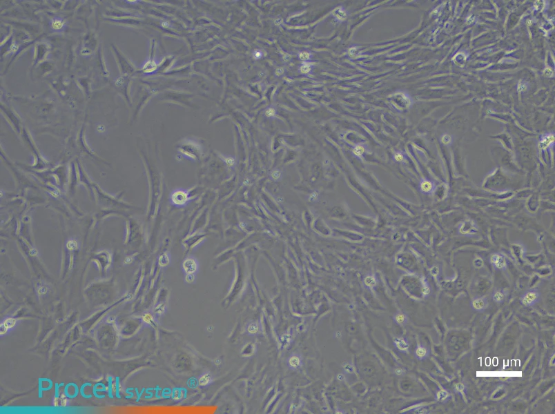 Rabbit Lung Fibroblast Complete Medium - 3