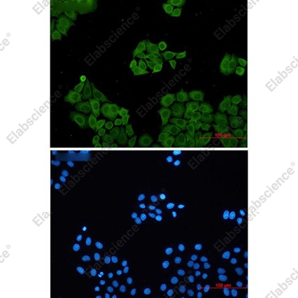 Recombinant CLIC1 Monoclonal Antibody - 2