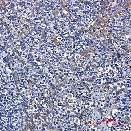 Recombinant Dynein Light Chain Tctex Type 1 Monoclonal Antibody - 5