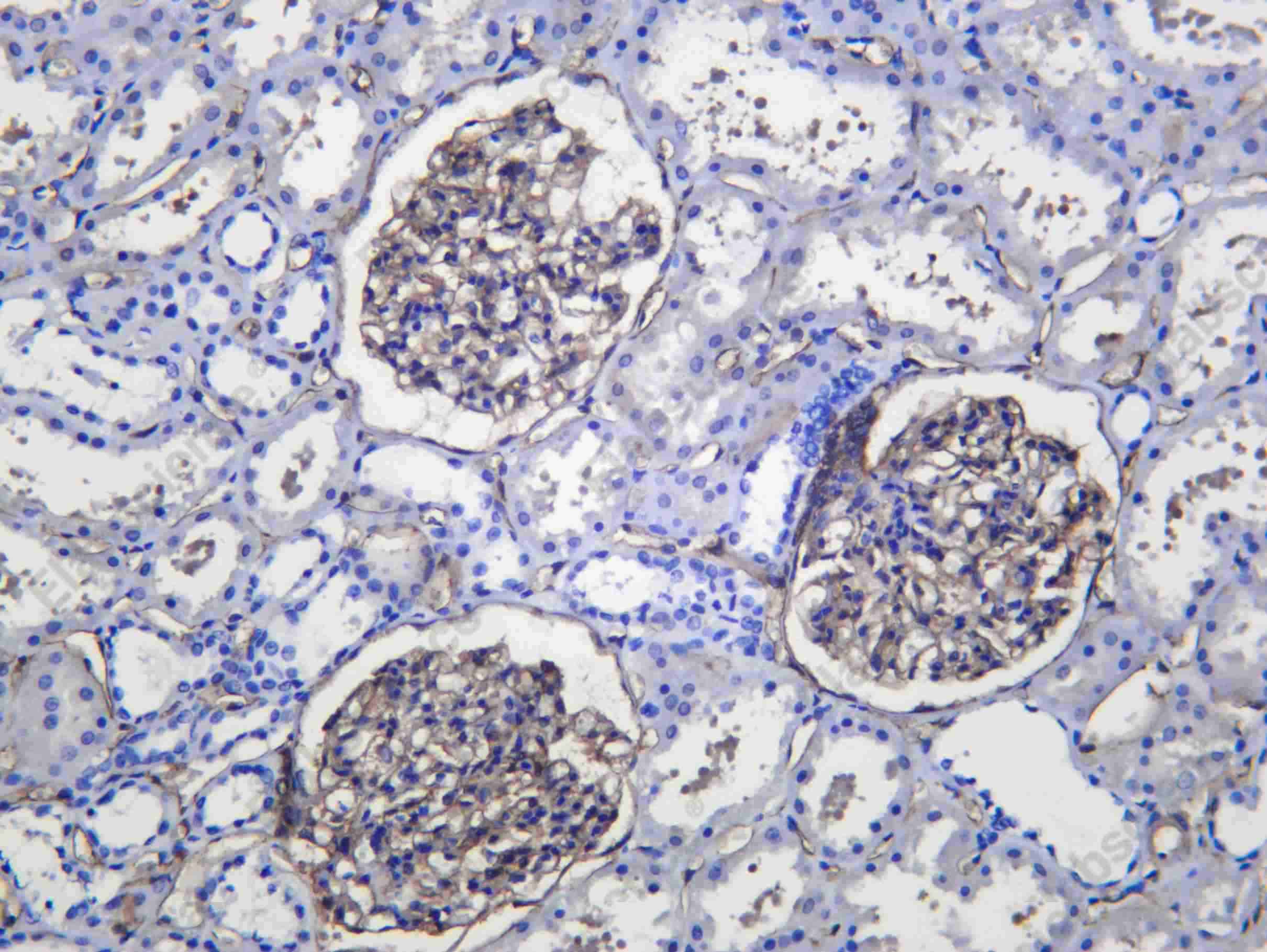 Recombinant CD200 Monoclonal Antibody - 2