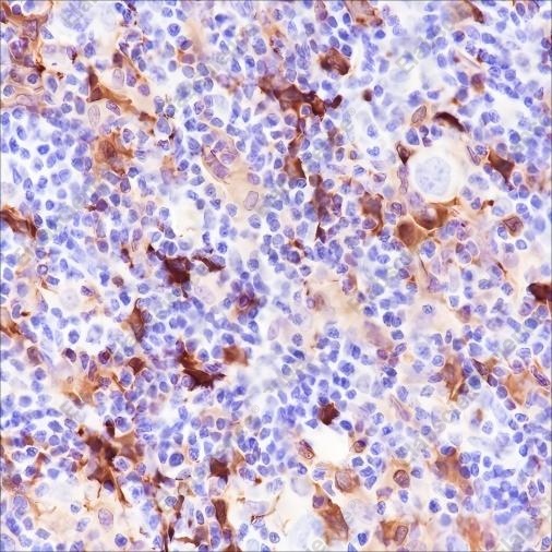 Recombinant Factor XIIIa Monoclonal Antibody - 3