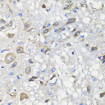 Immunohistochemistry of paraffin-embedded Rat brain using BCS1L Polyclonal Antibody at dilution of  1:100 (40x lens).