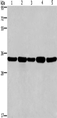 Western Blot analysis of LoVo and A549 cell, Human hepatocellular carcinoma tissue, Jurkat and Hela cell   using E2F6 Polyclonal Antibody at dilution of 1:650