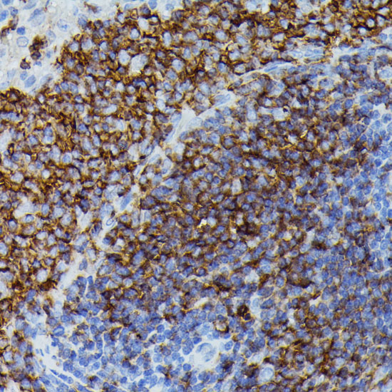 Immunohistochemistry of paraffin-embedded Rat spleen using APOC3 Polyclonal Antibody at dilution of  1:100 (40x lens).