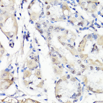 Immunohistochemistry of paraffin-embedded Human stomach using TBX20 Polyclonal Antibody at dilution of  1:100 (40x lens).