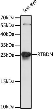 Western blot analysis of extracts of Rat eye using RTBDN Polyclonal Antibody at dilution of 1:1000.