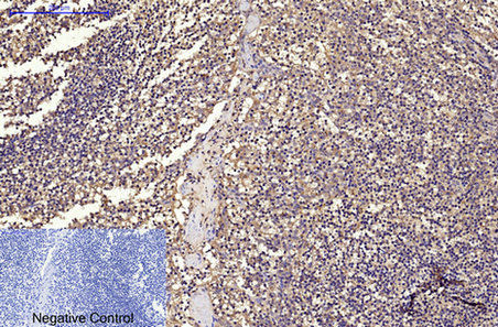 Immunohistochemistry of paraffin-embedded Human tonsil tissue using CD68 Monoclonal Antibody at dilution of 1:200.