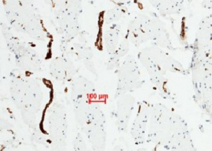 Recombinant vWF Monoclonal Antibody - small - 3