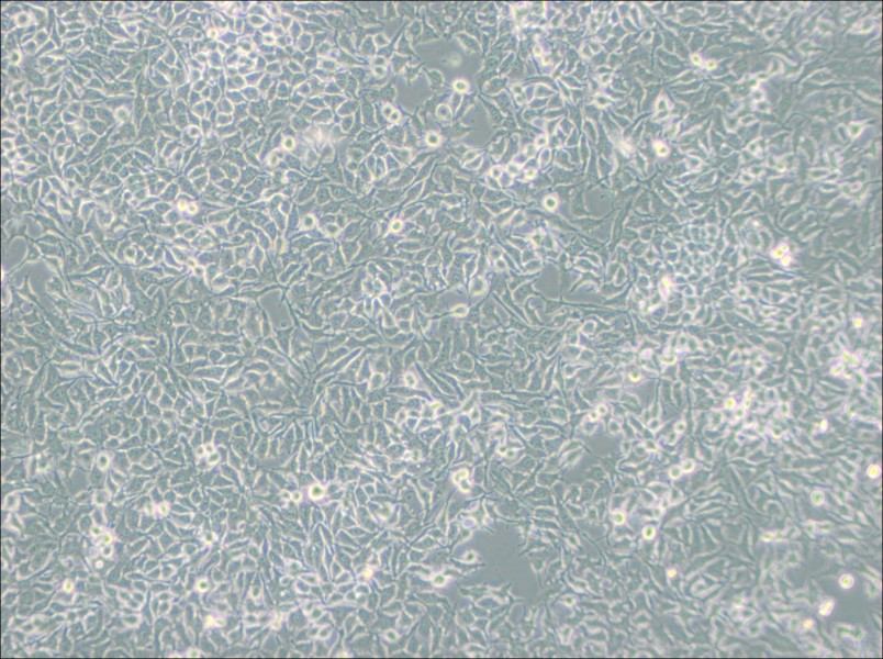 NCI-H3122 Cell Complete Medium - 3