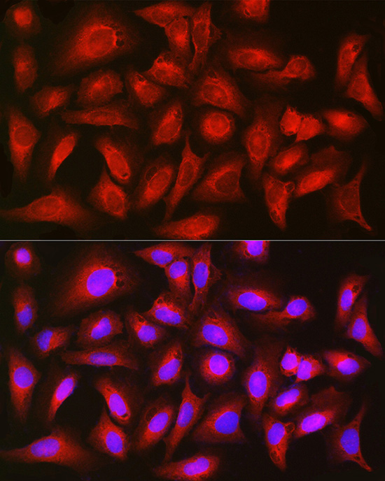 Immunofluorescence analysis of U2OS cells using TIGAR Polyclonal Antibody at dilution of 1:200 (40x lens). Blue: DAPI for nuclear staining.