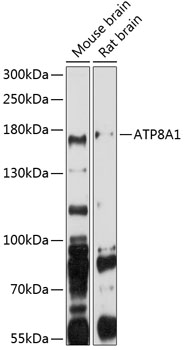 Western blot analysis of extracts of various cell lines using ATP8A1 Polyclonal Antibody at 1:1000 dilution.