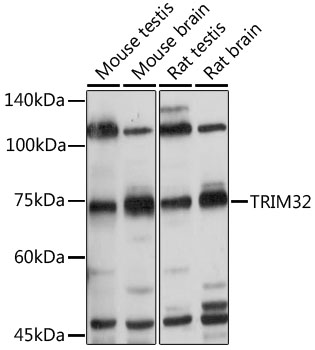 Western blot analysis of extracts of various cell lines using TRIM32 Polyclonal Antibody at 1:500 dilution.