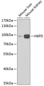 Western blot analysis of extracts of various cell lines using H6PD Polyclonal Antibody at 1:1000 dilution.