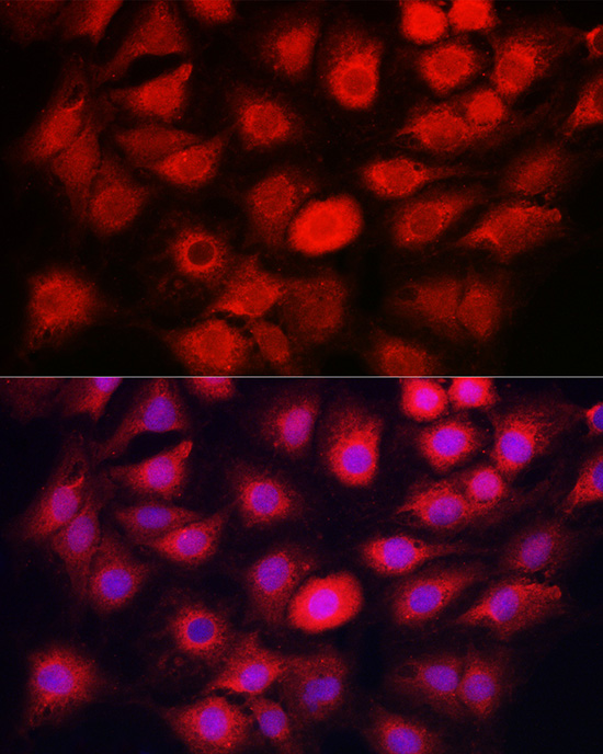 Immunofluorescence analysis of C6 cells using CASP1 Polyclonal Antibody at dilution of 1:50 (40x lens). Blue: DAPI for nuclear staining.