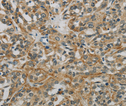 E2F6 Polyclonal Antibody - 3