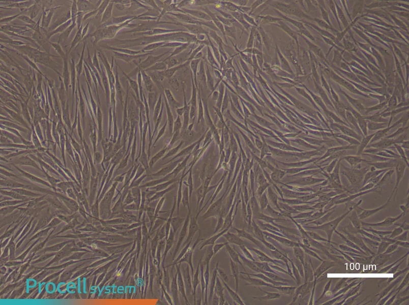 Human Pulmonary Artery Fibroblast Complete Medium - 2