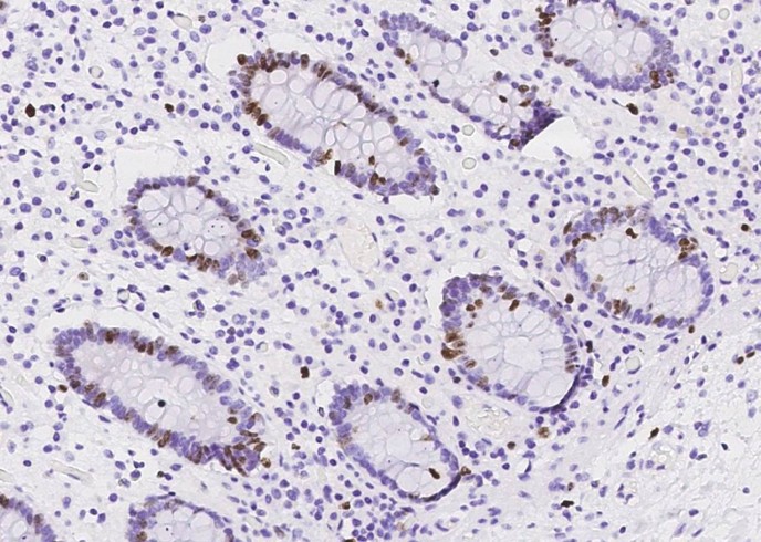 Ki67/MKI67 Monoclonal Antibody-searchlist-1