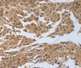 PSMD6 Polyclonal Antibody - 2