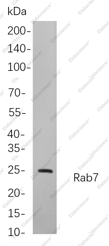 Recombinant Rab7 Monoclonal Antibody - 1