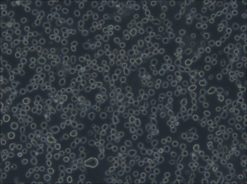 Karpas-299 Cell Complete Medium - 6