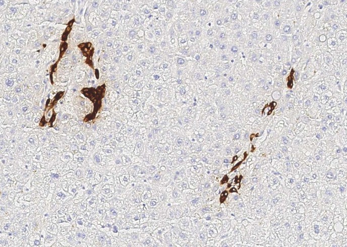 KRT19 Monoclonal Antibody - small - 2