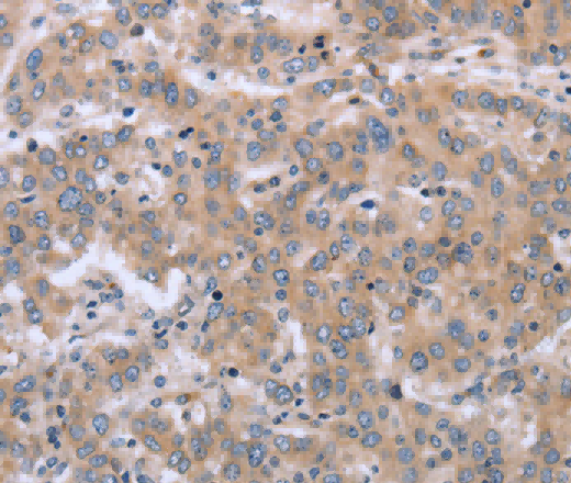 ECE1 Polyclonal Antibody - 2