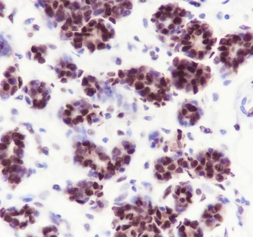 Recombinant NFIB Monoclonal Antibody - 2