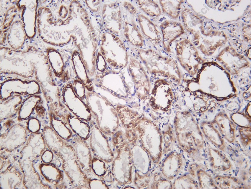 Recombinant IFNGR1/CD119/IFN-gamma-R1 Monoclonal Antibody - 4