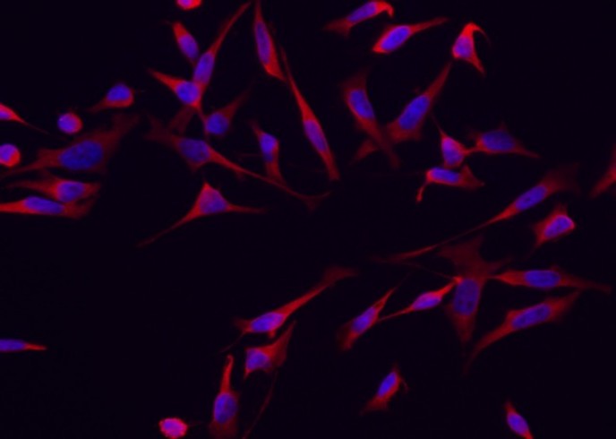RRM1 Monoclonal Antibody - small - 2