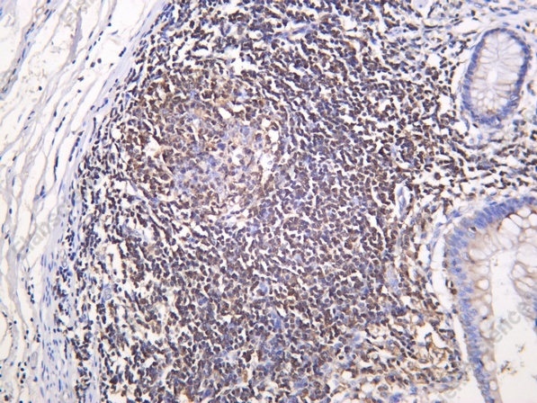 Recombinant HPK1 Monoclonal Antibody - 1