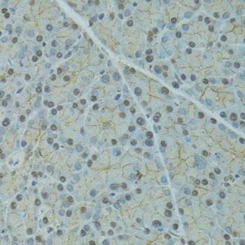 Immunohistochemistry of paraffin-embedded rat pancreas using SERPINF2 Polyclonal Antibody at dilution of 1:100 (40x lens).Perform microwave antigen retrieval with 10 mM PBS buffer pH 7.2 before commencing with IHC staining protocol.