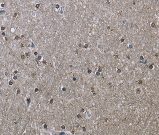 Immunohistochemistry of paraffin-embedded Human brain using HSPA9 Polyclonal Antibody at dilution of 1:50