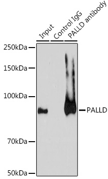 Immunoprecipitation analysis of 200ug extracts of A-549 cells using 3ug PALLD Polyclonal Antibody.Western blot was performed from the immunoprecipitate usi