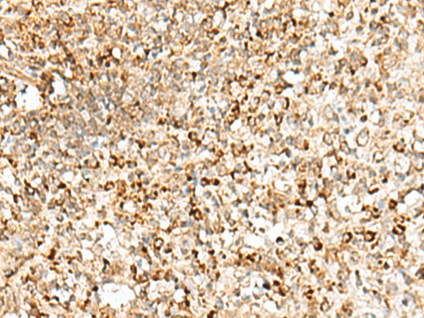 Immunohistochemistry of paraffin-embedded Human tonsil tissue  using TEX11 Polyclonal Antibody at dilution of 1:50(?200)