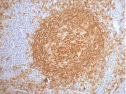 Immunohistochemistry of paraffin-embedded Human tonsil tissue using CD20 Monoclonal Antibody at dilution of 1:200.