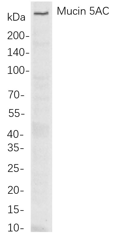 Recombinant Mucin 5AC Monoclonal Antibody-searchlist-1