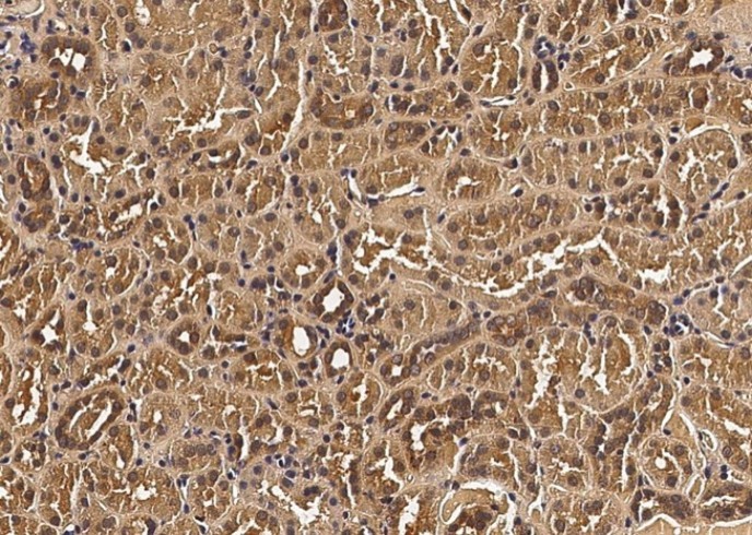 VEGF/VEGFA Monoclonal Antibody - small - 2