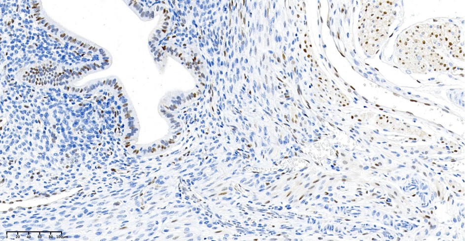 Recombinant Cyclin D1 Monoclonal Antibody - small - 4