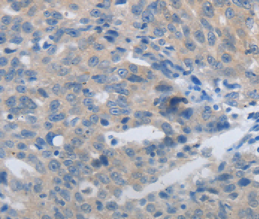 MMP8 Polyclonal Antibody - 3