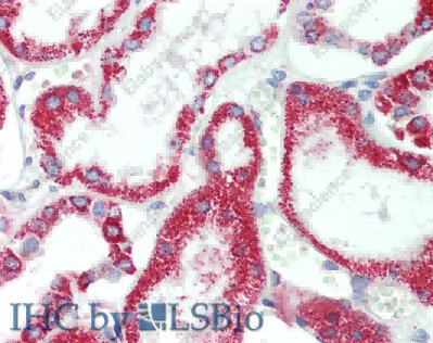 HSD17B8 Polyclonal Antibody - 3