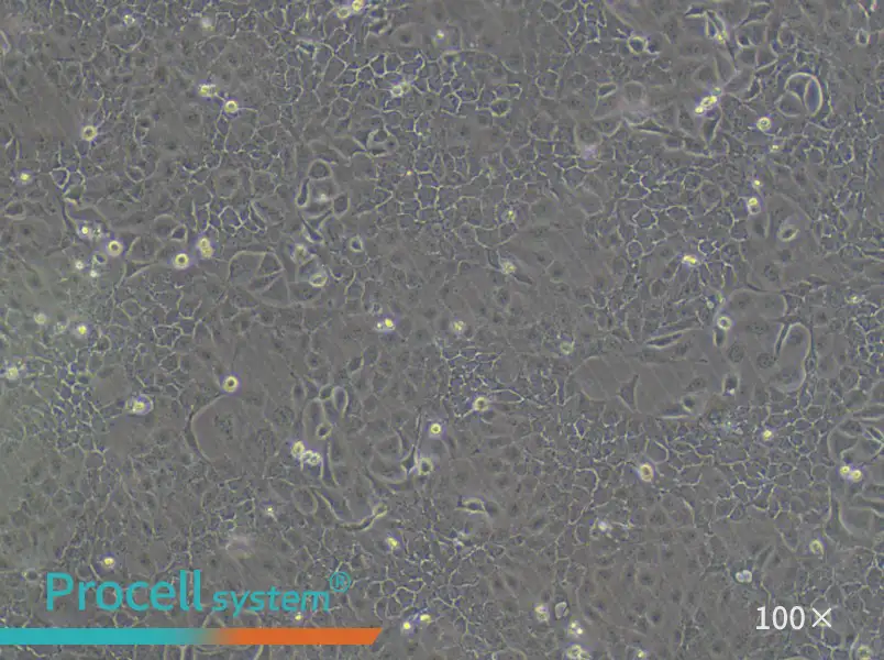 OVCAR-5 Cell Complete Medium - 1