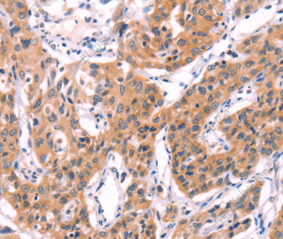 SERPINA5 Polyclonal Antibody - 2
